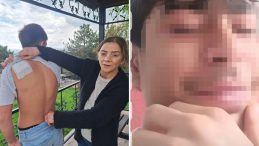 13 Yaşındaki Mete Bıçaklandı: Annesi Minguzzi Vakasına Dikkat Çekti