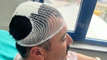 İl Başkan Yardımcısı, Belediye Başkan Yardımcısını Şekerlikle Yaraladı
