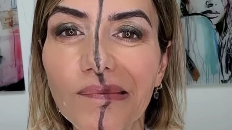 Yüzünün Sadece Bir Tarafına Botoks Uyguladı, Fark Ortaya Çıktı