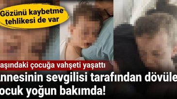2 Yaşındaki Çocuğa Vahşet: Annesinin Sevgilisi Tarafından Dövülen Çocuk Yoğun Bakımda!