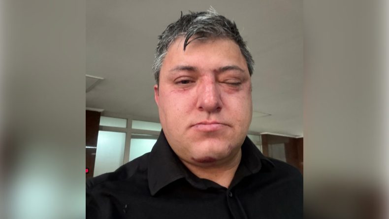 Belediye Çalışanından ‘Belediye Başkanı ve Yardımcıları Beni Darbetti’ İddiası
