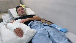 Bir Uyarı, Bir Tekme, İki Kırık, Sıfır Tutuklama: ‘Aileme Nasıl Bakacağım’