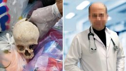Çöpte Bulunan Kafatasının Hikayesi: Uzman Doktorun Eşinin Temizliği Sonrası Ortaya Çıktı