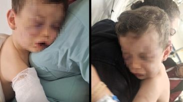 Devlet Korumasına Alınan Aren Bebek Ameliyat Olacak