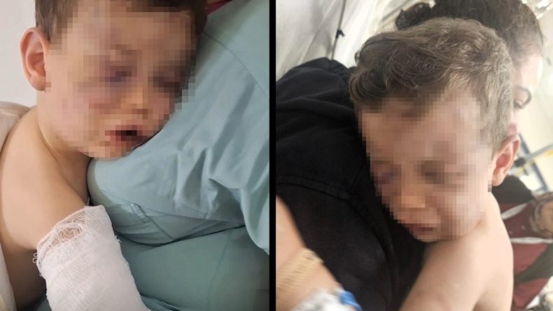 Devlet Korumasına Alınan Aren Bebek Ameliyat Olacak