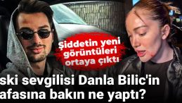 Eski sevgilisi Danla Bilic’in kafasına bakın ne yaptı? Şiddetin yeni görüntüleri ortaya çıktı