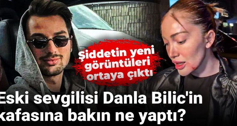 Eski sevgilisi Danla Bilic’in kafasına bakın ne yaptı? Şiddetin yeni görüntüleri ortaya çıktı