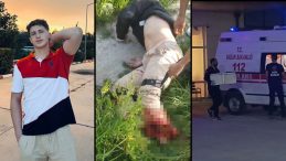Üniversiteli Genç Motosiklet Kazasında Bacağını Kaybetti