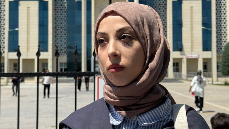 Yüzündeki Morlukla Haykırdı: Kadın Cinayeti Olarak Anılmak İstemiyorum