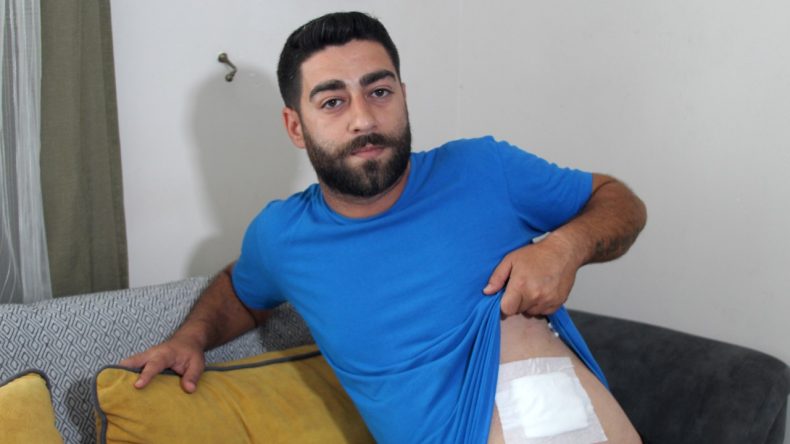 Bayram Ziyareti Sırasında Yaralandı