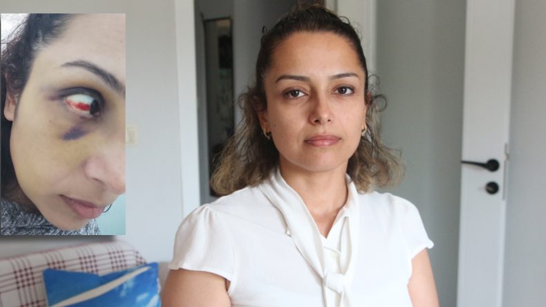 Bir Kadın Daha ‘Ölmek İstemiyorum’ Diye Haykırdı! Burcu Öğretmenin Sesi Duyulacak Mı?