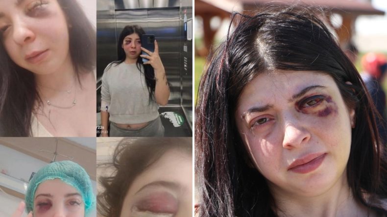Damla’yı Sokak Ortasında Darbeden Sanık Serbest Bırakıldı