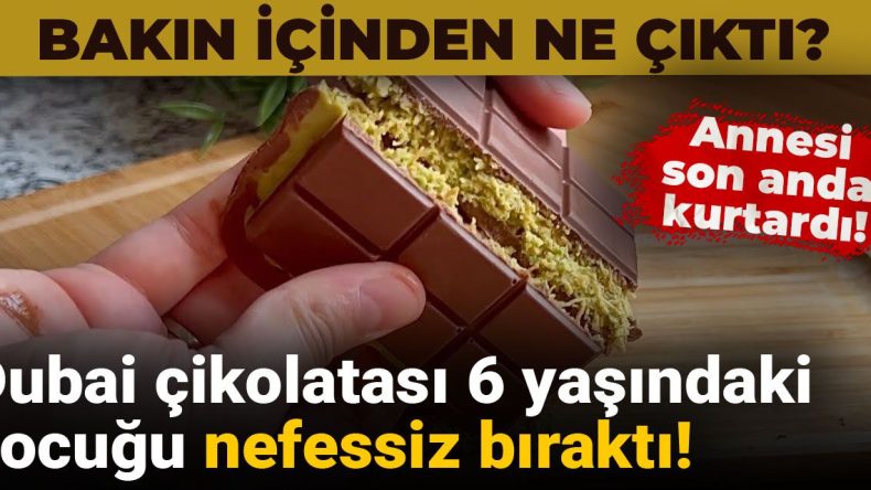 Dubai Çikolatası, 6 Yaşındaki Çocuğu Nefessiz Bıraktı! Ne Çıkmış Olabilir?