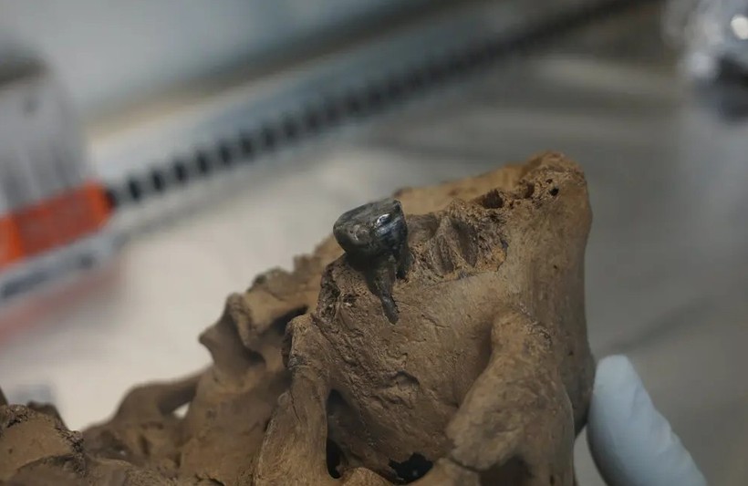 Diş Plağı Fotoğrafı