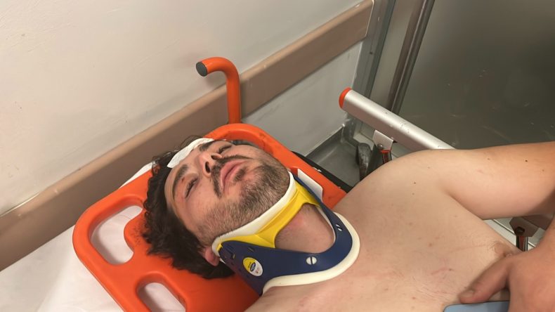 Genç Oyuncuya Trafikte Dayak: “Öldürene Kadar Döveceklerdi”