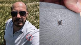 Ölüm Saçıyor! Selfie Çekerken Üzerinde Keneleri Fark Etti