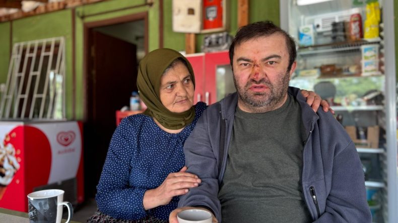 Polis, Acımasızca Darp Edilen Engelli Vatandaşın İfadesini Almaktan İki İhtimalle Kaçındı