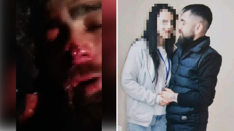 Evli Kadının Sevgilisine Uyguladığı İşkence İddiası